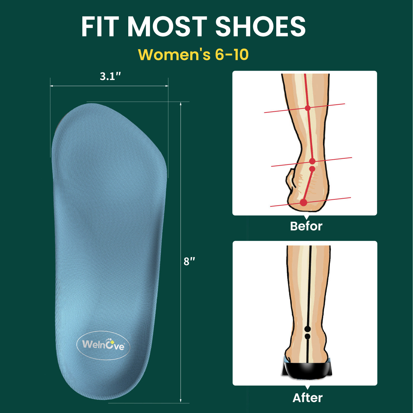 Insole Arch Support - 2pcs Female Arch Support Pad Orthopedic